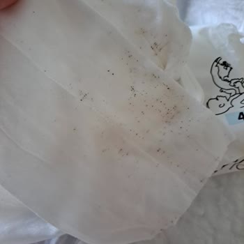 Bebek Islak Mendilinde Küflenme Ve Sağlık Riski