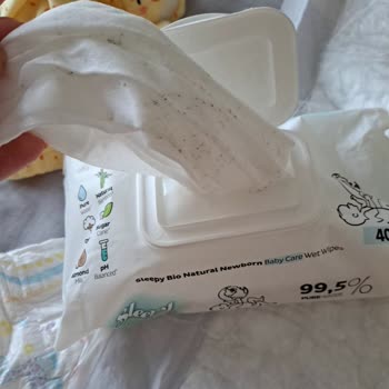 Bebek Islak Mendilinde Küflenme Ve Sağlık Riski