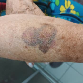 Bazalı Oturma Sandığında Hidrolik Eksikliği Ve Sorumsuz Çözüm Süreci