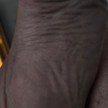 Kısa Sürede Deforme Olan Sandalet İçin Çözüm Sunulmadı