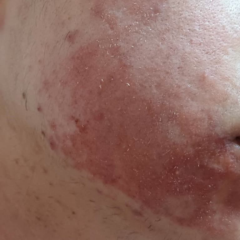 Cosmed Ürünleri Cildimi Mahvetti, Destek Ve İade Talebim Yanıtsız Kaldı