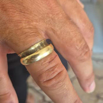 Assos Alyans Kısa Sürede Kırıldı, Parmak Kesilmesine Ve Mağduriyete Yol Açtı