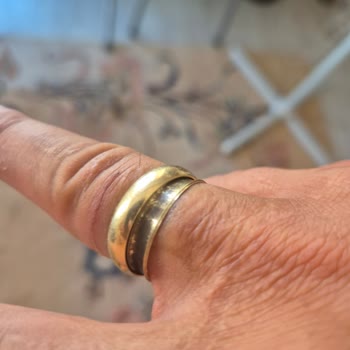 Assos Alyans Kısa Sürede Kırıldı, Parmak Kesilmesine Ve Mağduriyete Yol Açtı