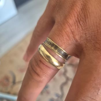 Assos Alyans Kısa Sürede Kırıldı, Parmak Kesilmesine Ve Mağduriyete Yol Açtı