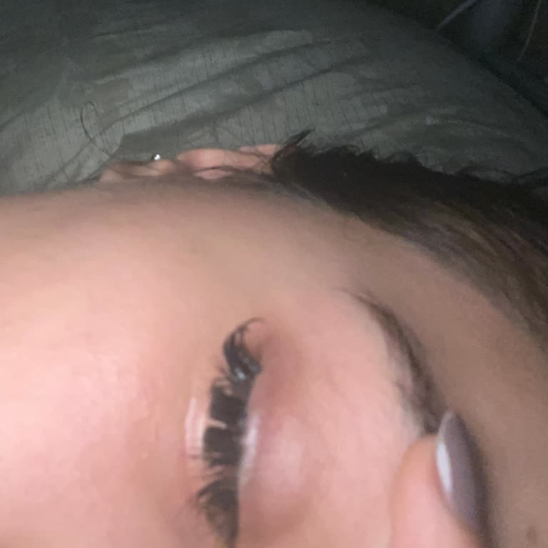 Yanlış Uygulanan Kirpik İşlemi Sonrası Rahatsızlık Ve İade Talebi