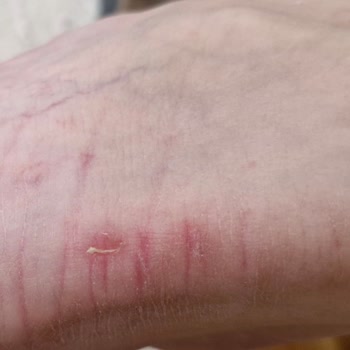 Yüksek Fiyatlı Ayakkabı İlk Giyişte Yara Yaptı