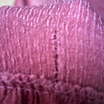 Yırtık Elbise Teslimatı Ve Cevapsız Kalan Şikayet