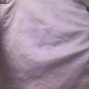 Vanish Kosla Leke Çıkarıcı Pantolonumda Geri Dönüşü Olmayan Renk Açılmasına Yol Açtı