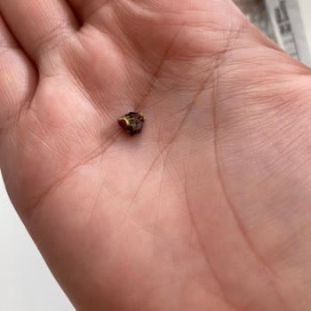 S****** G******* İçinden Çıkan Yabancı Parça Dişimi Kırıyordu