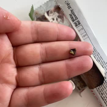 S****** G******* İçinden Çıkan Yabancı Parça Dişimi Kırıyordu