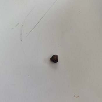 S****** G******* İçinden Çıkan Yabancı Parça Dişimi Kırıyordu