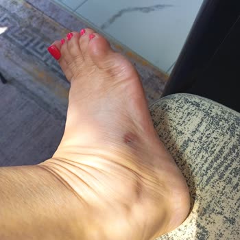 Crocs Terlik Tatilde Hayal Kırıklığı Yarattı