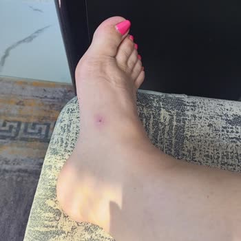 Crocs Terlik Tatilde Hayal Kırıklığı Yarattı