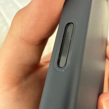 Kılıfın Kamera Tuşu 3 Ayda Neredeyse Düştü Servis Yardımcı Olmadı