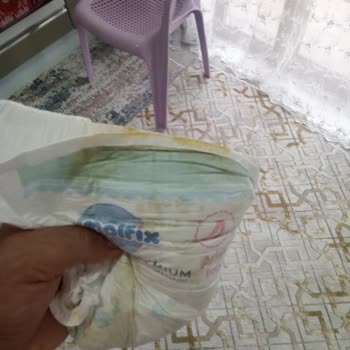 Molfix 4 Numara Bebek Bezinde Tekrarlayan Sızdırma Ve Cilt Sorunu Mağduriyeti