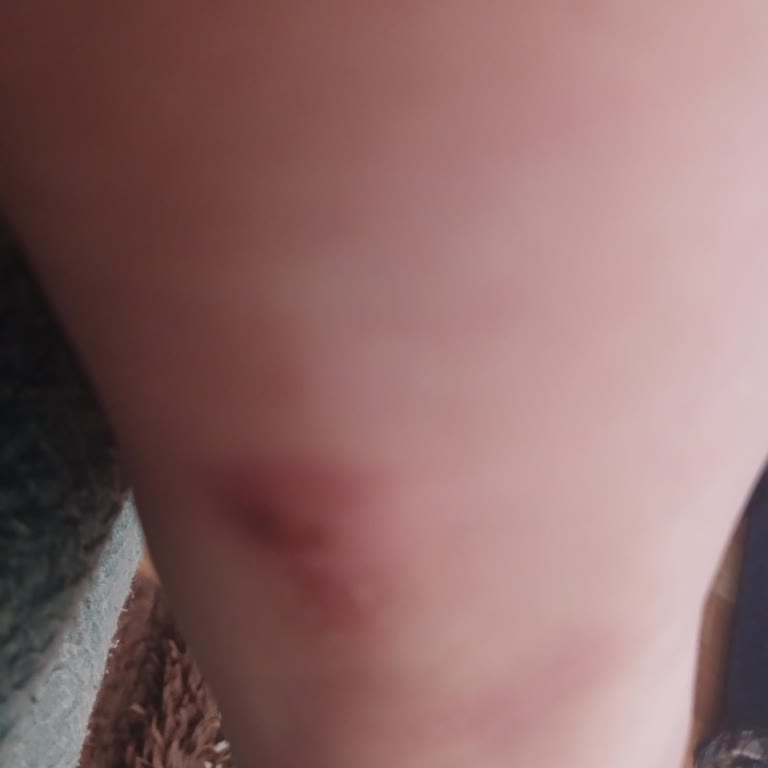 Kinetix Ayakkabı Topuk Kısmı Ayağımı Yaraladı Değişim Talep Ediyorum