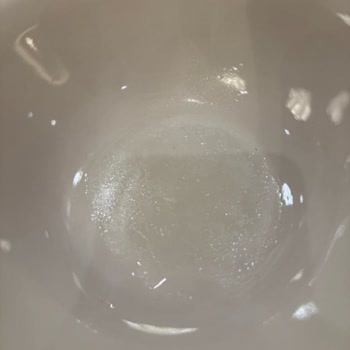 Kaya Belek Palazzo Otel’de Hijyen Sorunları Ve ETS Tur’un İlgisizliği Nedeniyle Yaşanan Mağduriyet