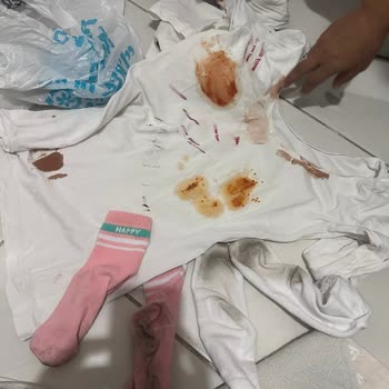 Bosch Çamaşır Makinesi Lekeleri Çıkarmıyor Servis Çözüm Sunmuyor