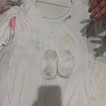 Bosch Çamaşır Makinesi Lekeleri Çıkarmıyor Servis Çözüm Sunmuyor