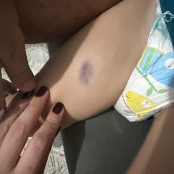 Acil Serviste Yetersiz Müdahale Ve İlgisizlik Nedeniyle Yaşanan Mağduriyet