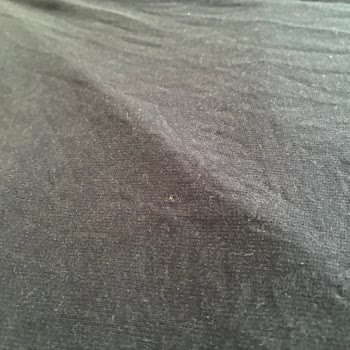 Profilo Çamaşır Makinesinde Sürekli Tozlanma Ve Temizlik Sorunu, Servisten Çözüm Alınamıyor