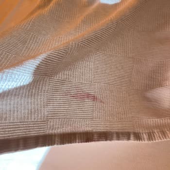 Hijyen Ve Temizlik Sıfır: Tatil Hayal Kırıklığına Döndü