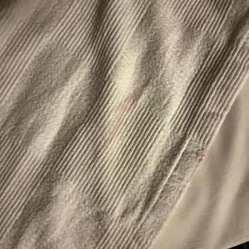 Hijyen Ve Temizlik Sıfır: Tatil Hayal Kırıklığına Döndü