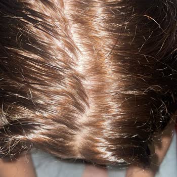 Yanlış Ürün Nedeniyle Saç Renginde Ve Sağlığında Sorun Yaşadım