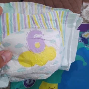 Bebek Bezinden Çıkan Yabancı Madde Ve Alerji Sorunu