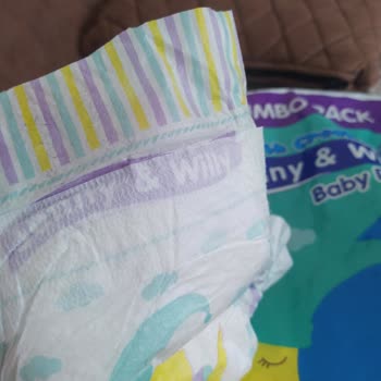 Bebek Bezinden Çıkan Yabancı Madde Ve Alerji Sorunu