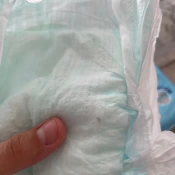 Molfix Bebek Bezlerinde Tekrar Eden Siyah Partikül Sorunu