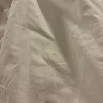 Otel Odasında Temizlik Ve Hizmet Sorunlarıyla Karşılaştık