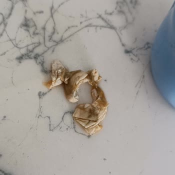 Üründe Hijyen Sorunu Ve Satıcıdan Yanıtsızlık