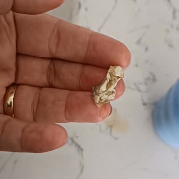 Üründe Hijyen Sorunu Ve Satıcıdan Yanıtsızlık