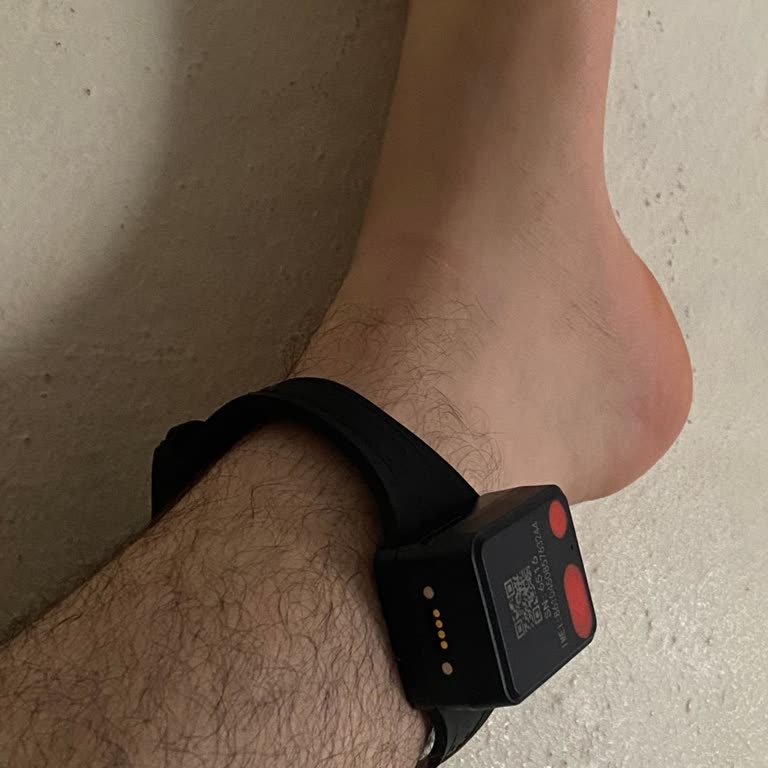 Adalet Bakanlığı Haksız Elektronik Kelepçe Yüzünden Sağlık Ve Sosyal Hayatım Altüst Oldu