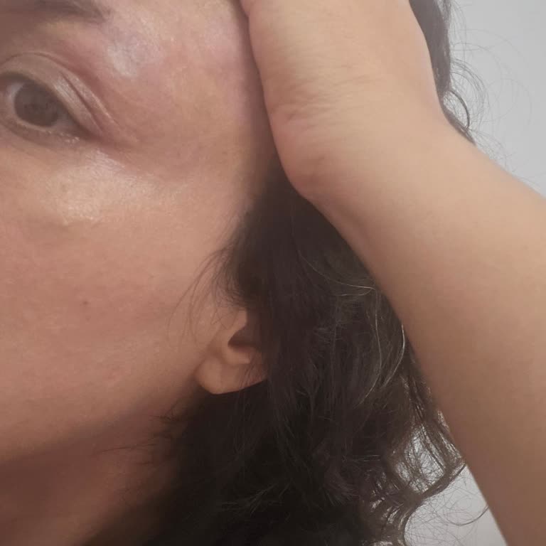 Mezoterapi Sonrası Şişlik Ve İlgisiz Müşteri Hizmetleriyle Mağduriyet Yaşadım