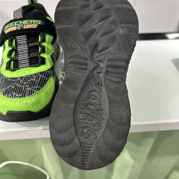 20 Günde Soyulan Ayakkabı Ve Red Edilen Garanti Talebi