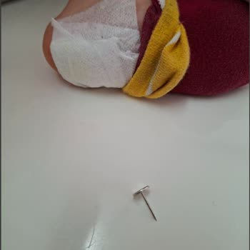 Çocuğumun Ayağına Ayakkabı İçindeki İğne Battı, Mağaza İlgisiz Kaldı