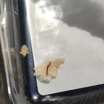 Dardanel Sandviçin İçinde Hamam Böceği Parçası Buldum, Sağlığım Ve Güvenim Sarsıldı