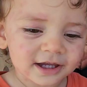 Kanalizasyon Kaynaklı Çevre Kirliliği ve Sinek Sorunu Hakkında Şikayet