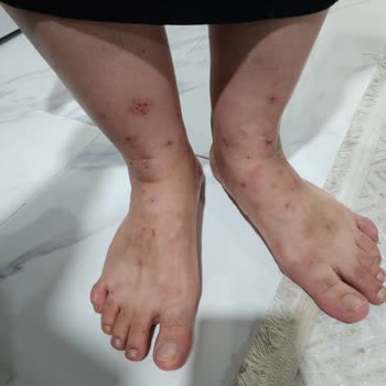 Kanalizasyon Kaynaklı Çevre Kirliliği ve Sinek Sorunu Hakkında Şikayet