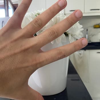 Hayal Kırıklığı Yaratan Çiçek Siparişiyle Özel Günüm Mahvoldu