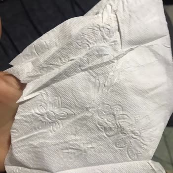 Papia Tuvalet Kağıdında Beklenmedik Kalite Sorunu Yaşadım!