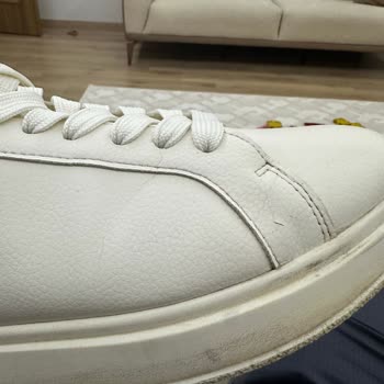 Zara Ayakkabım Kısa Sürede Çatladı Ve Destek Alamadım