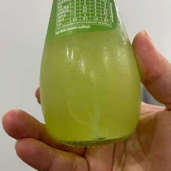 Satın Alınan Soda Şişesinde Yabancı Cisim Bulunması Ve Hijyen Endişesi