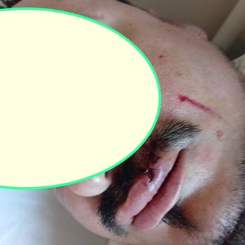 İşletmede Güvenlik Zafiyeti Ve Müşteriye Yönelik Şiddetli Saldırı