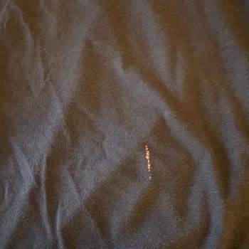 Migros Ekinoba'da Patlayan Çamaşır Suyu Nedeniyle Cilt Yanığı Ve Kıyafet Zararı Yaşadım