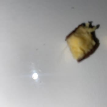 A101 Cino Mini Çikolata Paketinde Kıl Çıkması Ve Hijyen Sorunu