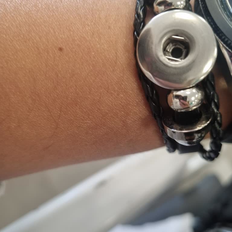 Satın Aldığım Bilekliğin Taşı Kısa Sürede Düştü, Garanti Ve İade Talebim Reddedildi