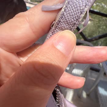 Samsonite Omuz Çantasında Kısa Sürede Deri Soyulması Ve Çözüm Sunulmaması